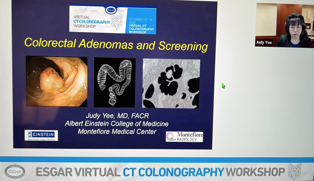 Terrific #CTColonography workshop today @EsgarSociety. Great interest with a global audience in learning about CTC and #colorectalcancer screening.