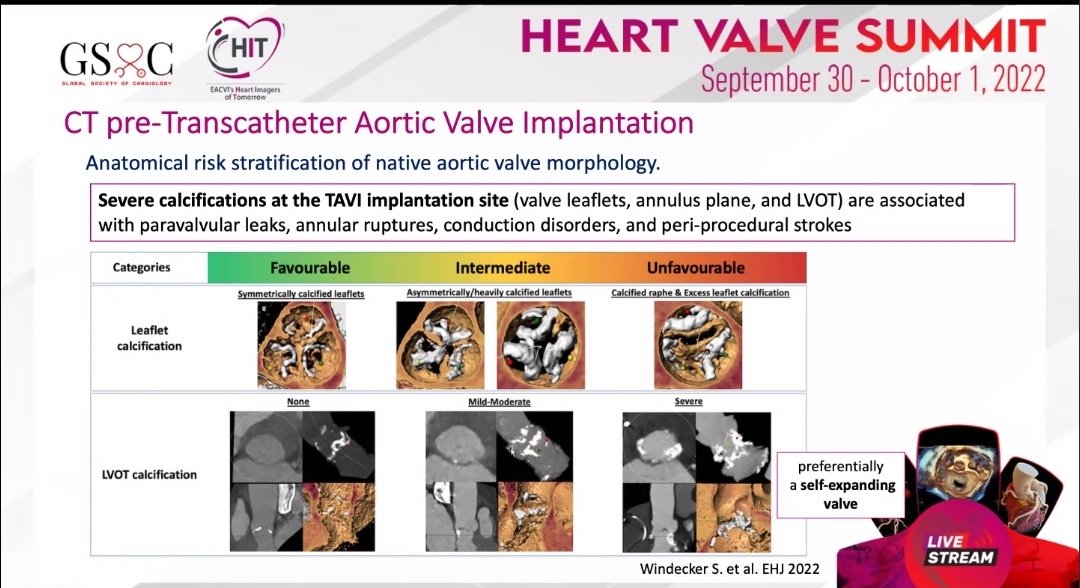 drmilicaa's tweet image. #whyCCT before #TAVI
Excellent explanation by @PezelT

@GSoCers @iyacpeople @saskavaska @N_cardiologist @VDelgadoGarcia @alessia_gimelli @NMerke @dr_maghraby @KemalogluOz @JasonKatzMD @ZainabDakhil2 @aayshacader @mirvatalasnag @alexsfelixecho