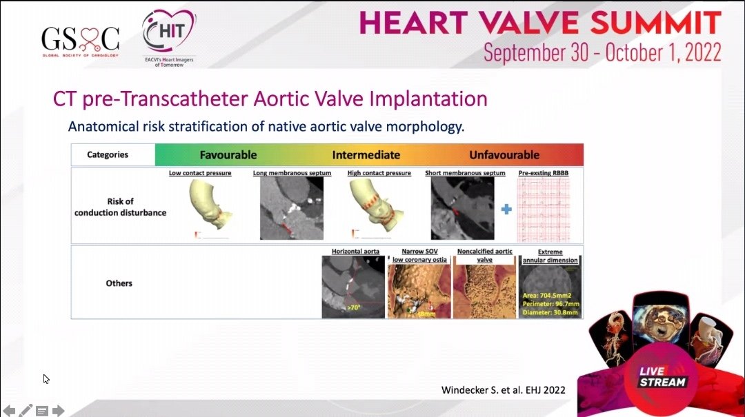 drmilicaa's tweet image. #whyCCT before #TAVI
Excellent explanation by @PezelT

@GSoCers @iyacpeople @saskavaska @N_cardiologist @VDelgadoGarcia @alessia_gimelli @NMerke @dr_maghraby @KemalogluOz @JasonKatzMD @ZainabDakhil2 @aayshacader @mirvatalasnag @alexsfelixecho