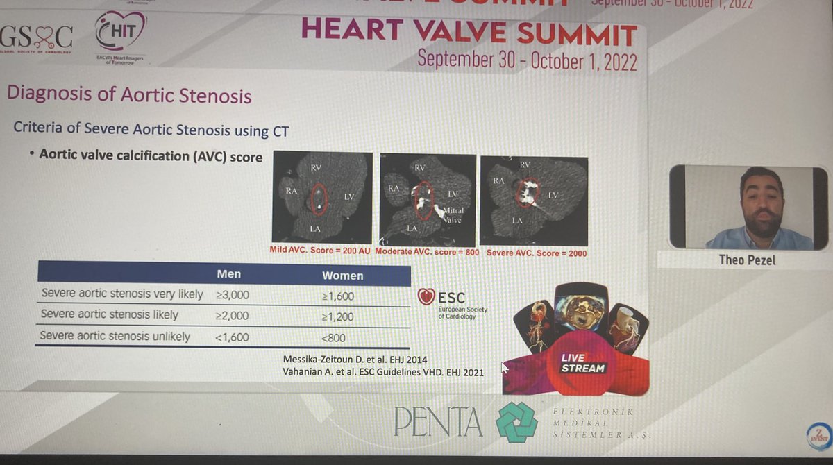 LuchianLuiza's tweet photo. @PezelT @NMerke @EACVIPresident #HIT second day #HeartValveSummit @GSoCers @DrHaniMahmoud @KemalogluOz Another beautiful discussion on what is new and mandatory to know about aortic stenosis #echofirst #whyCT https://t.co/WGSBD5mrzE