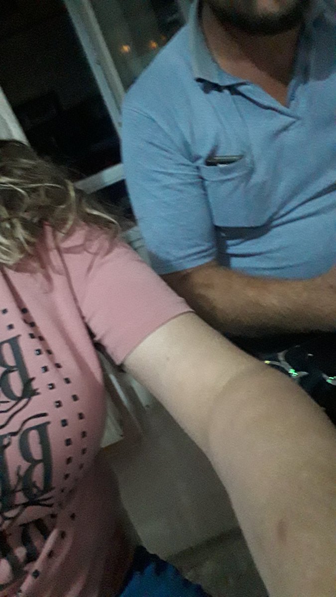 AslVeAli1's tweet photo. Ankara'da artık çift kalmamış arkadaşlar Nerede bu çiftler https://t.co/3sHZwCiuoC