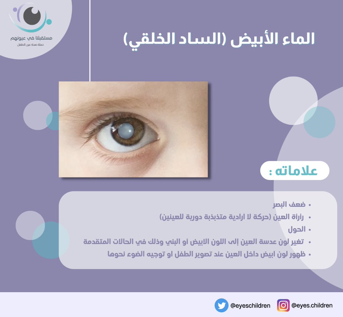 EyesChildren's tweet photo. 📎 ماهو الماء الأبيض ( الساد الخلقي) ؟

#صحه_العين
#مستقبلنا_في_عيونهم https://t.co/hztV5uBIEc