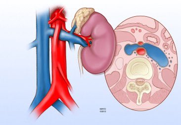 Nutcracker syndrome is the compression of the left renal vein by the superior mesenteric artery. 

It can mimic other urologic disease, as it’s symptoms are often nonspecific including flank pain, hematuria, pelvic congestion, or varicocele.