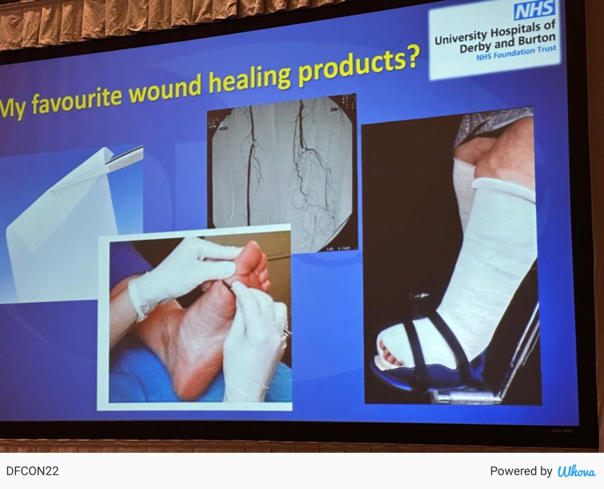DGArmstrong's tweet photo. Fran’s favorites #DFCON22 #ActAgainstAmputation #DiabeticFoot #ALPSlimb @franners13 via Whova event app https://t.co/CKW5uxtRka https://t.co/e2thgXS8PX