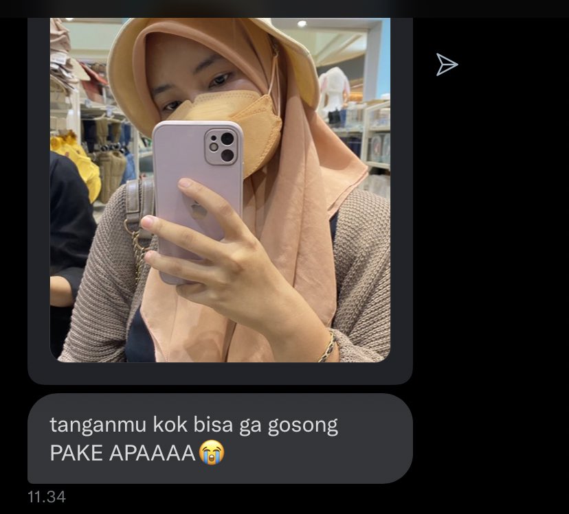 dhilxa's tweet photo. CARA MENGHILANGKAN BELANG KAKI &amp; TANGAN ala admin @dhilxa

*estimasi kurang lebih 2bulan 
*user sepeda motor di panas terik kota surabaya 
*mostly products dibeli di shopee 
*bukan konten promosi

A thread https://t.co/qr5GtDcBAP