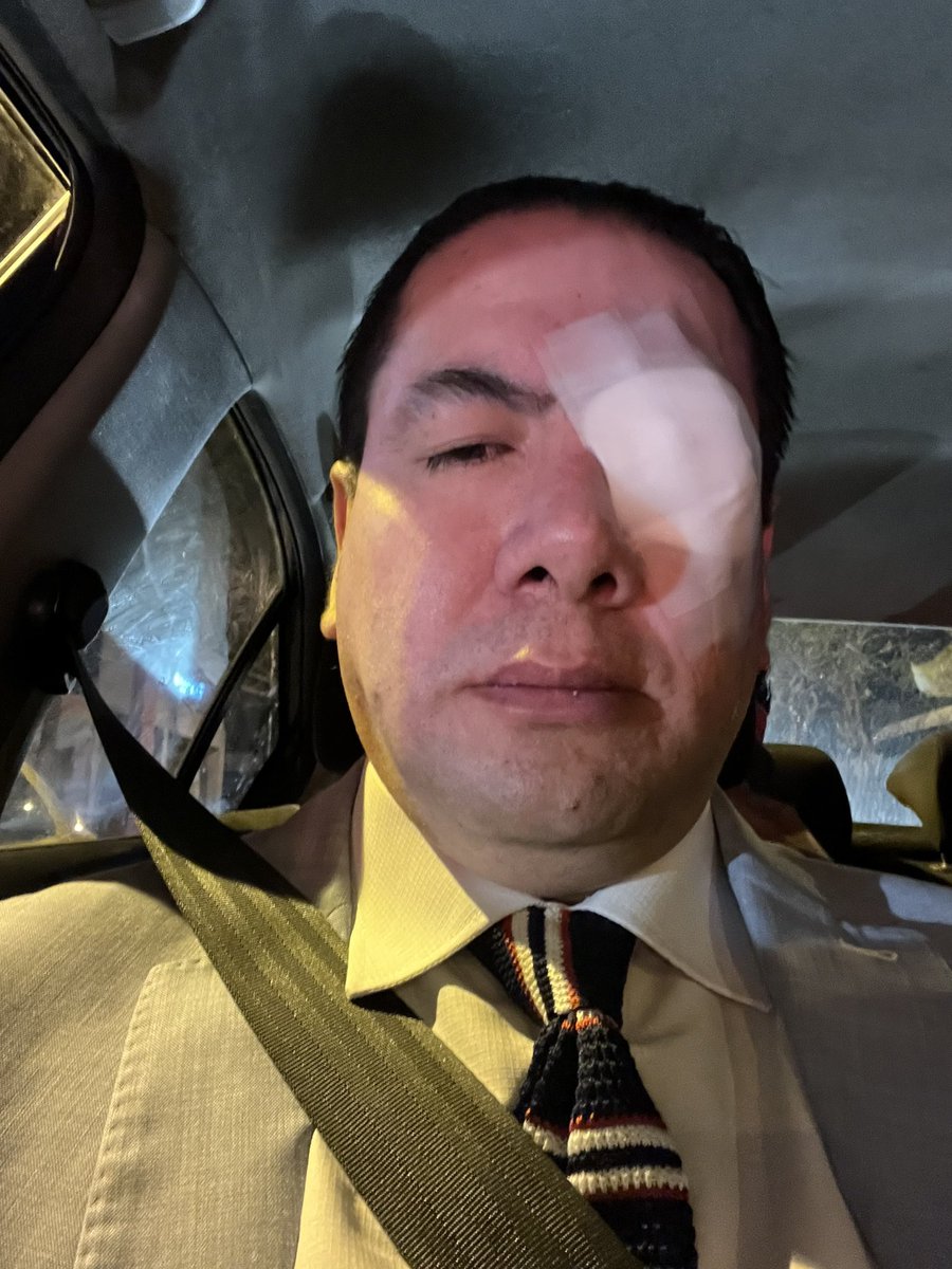 foguevara's tweet photo. @MunicipioQuito @santiguarderas hacen pocas obras y no cumplen con las seguridades a la ciudadanía, hoy sufrí un accidente quien responde https://t.co/MmJOQGgPRR