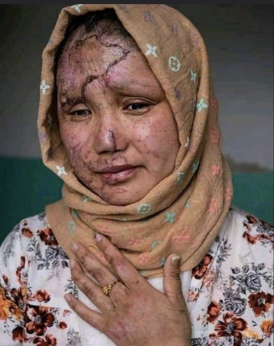 qayum_lakanwal2's tweet photo. A picture with millions of messages of pain, sadness and misery against injustice, cruelty and discrimination 💔
#Stop_Killing https://t.co/5MGHjClTFw