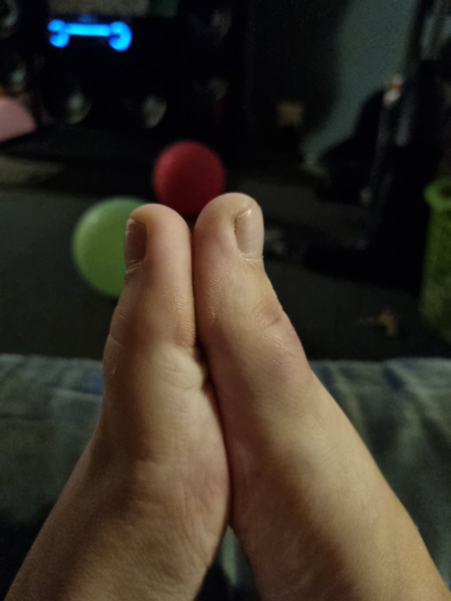 _TamaraWatson's tweet photo. When someone tells you you're all thumbs 👍 #toethumbs https://t.co/B2KHkMptE5