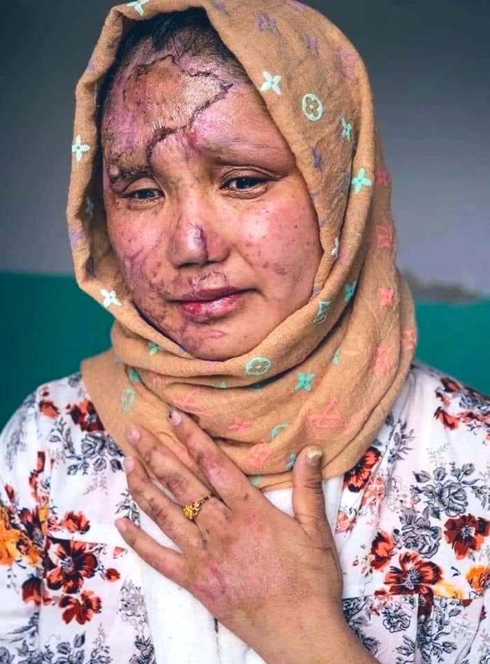 reza72077063's tweet photo. برای درد، برای زخم‌هایی که التیام نمی‌یابند 
#StopHazaraGenocide https://t.co/8zDaBhd0AW