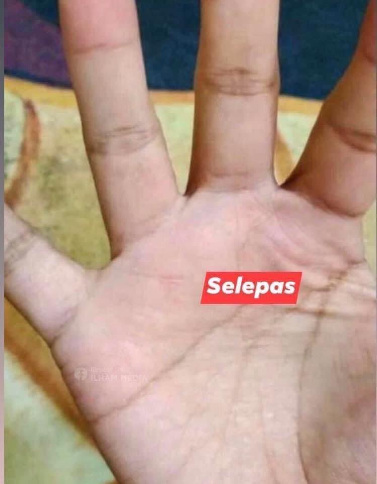 officialfans95's tweet photo. Tak sangka pakai krim vaseline ni hilang alergik kat celah celah jari ni.. Ya Allah azab sangat tau, kene air pun sakit.. Nak basuh pinggan pun susah.. Korang cuba lah mana tahu serasi..
.
Harga pun tak sampai rm10: https://t.co/hDIqvO11B3 https://t.co/MSMxvZhrZb