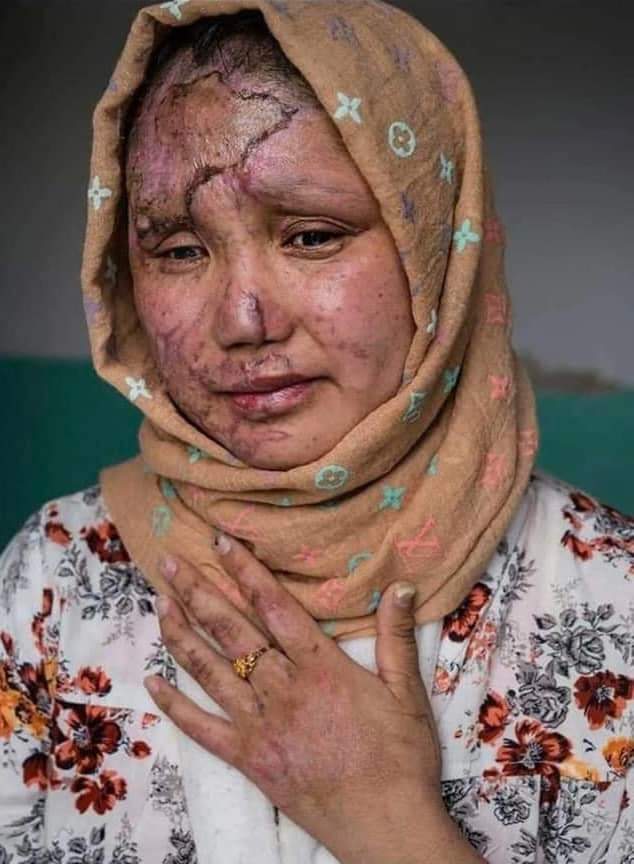 MurtazaBahrami's tweet photo. AFGHANISTAN will be never safe for  us (HAZARA)
#StopHazaraGenocide 
#StopKillingHazara https://t.co/qVDNjlyWS9