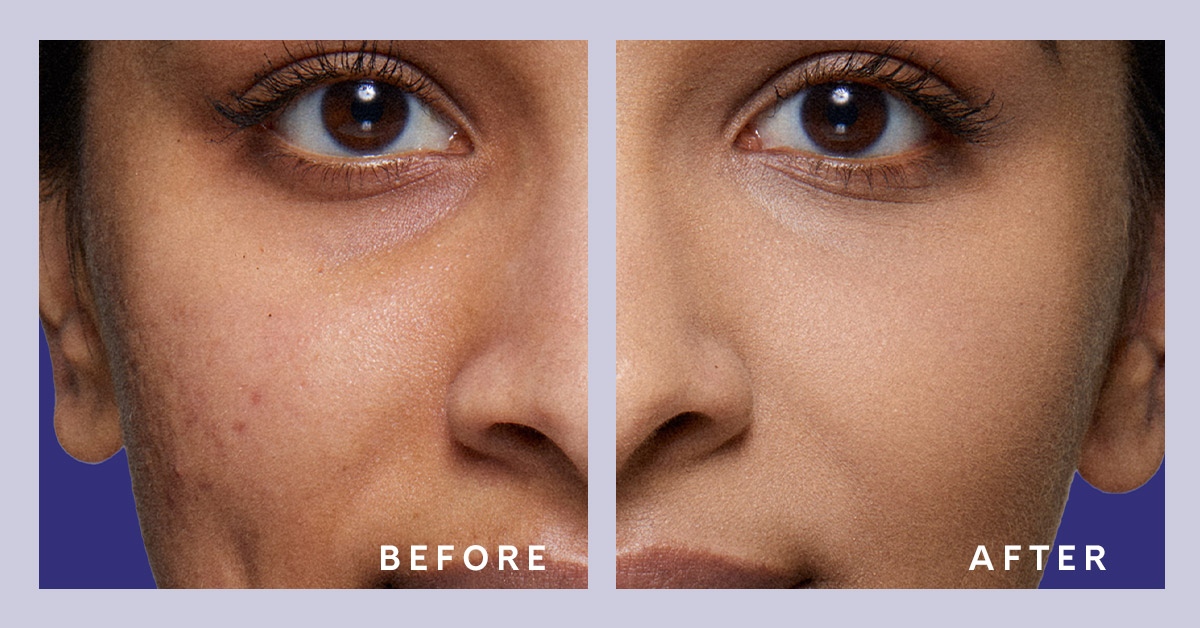 LovelySkin.com tweet media