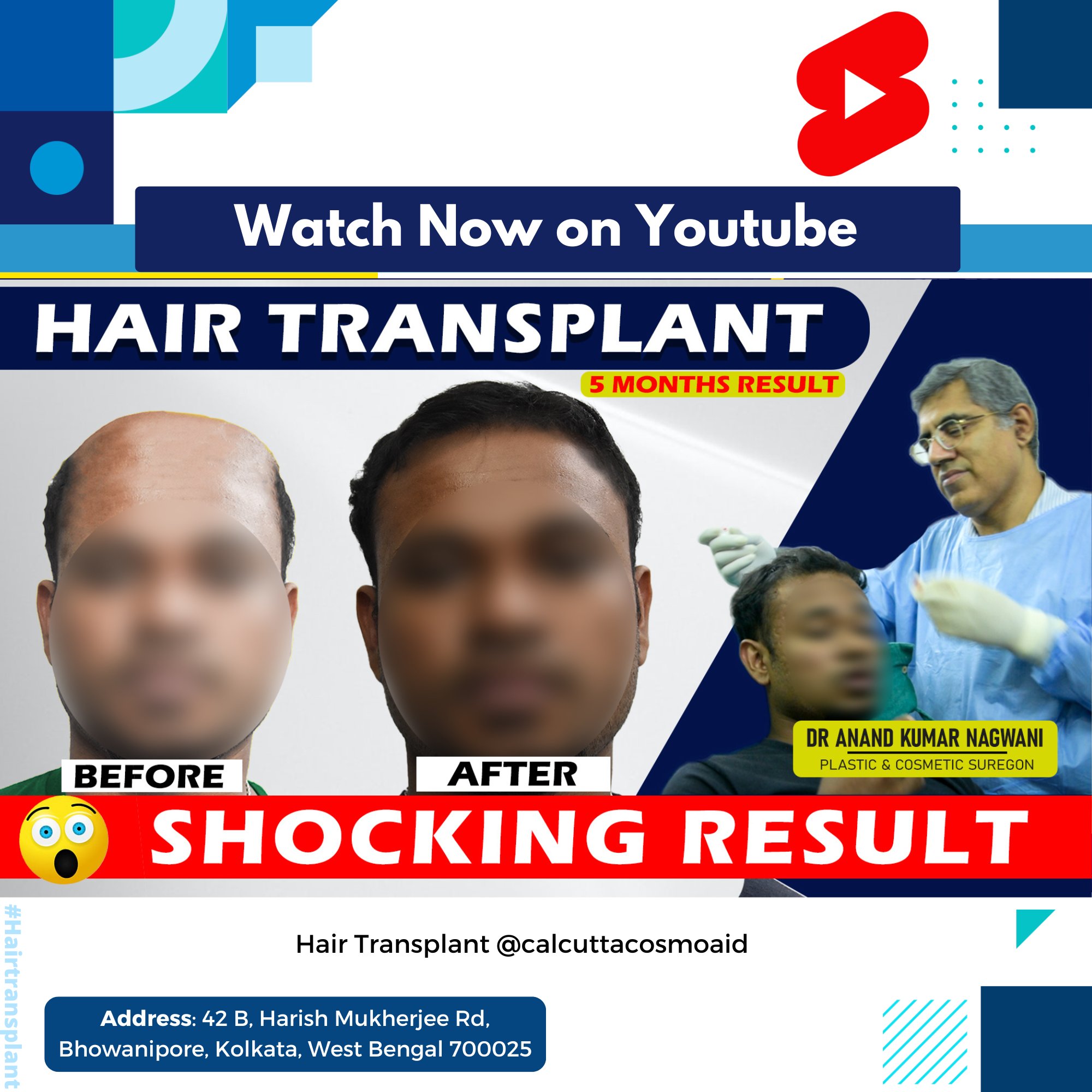 Dr Anand K Nagwani - Hair Transplant on X: Breast Augmentation is