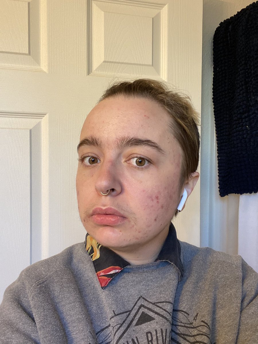 wordsabouttrees's tweet photo. the face grease? that acne? seven layers of goodwill shirts? the look of confused discomfort? that's the tboy swag, baybee! i'm glowing ✨ https://t.co/DEoX0AxX9G