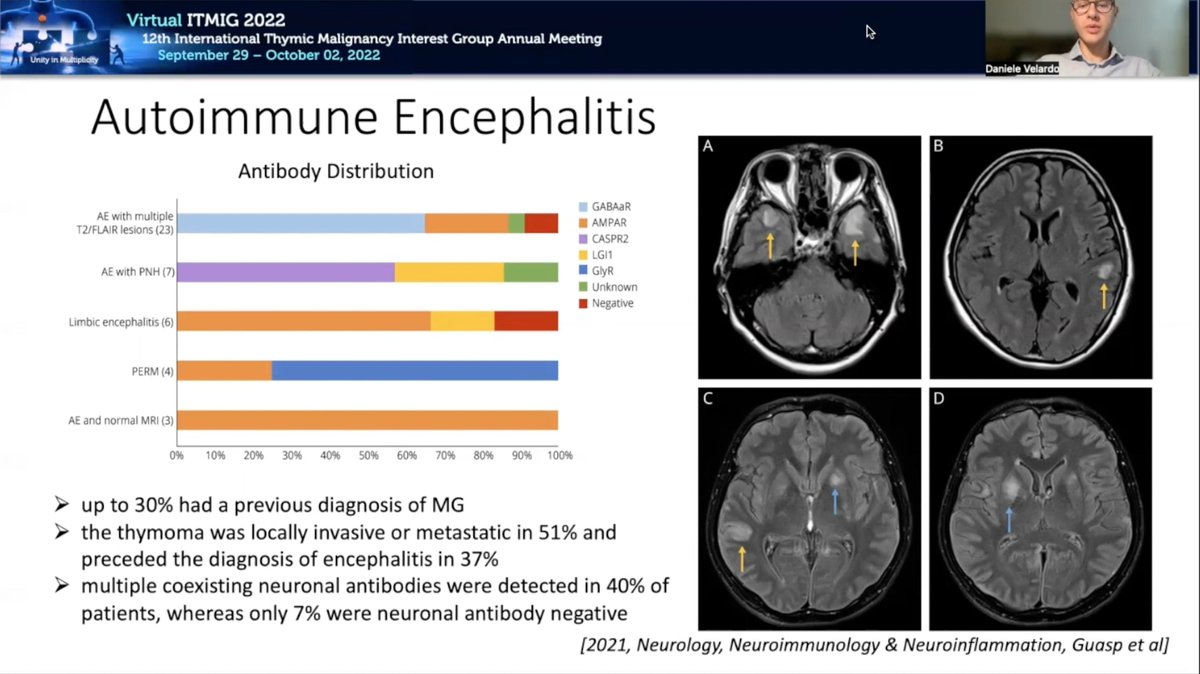 chulkimMD's tweet photo. Last day of 12th #ITMIG annual meeting (@Itmig_society)
Thymic epithelial tumors are rarely a/w CNS autoimmunity
A great talk by Dr. Daniele Velardo
Early & aggressive Tx is key
Characterization of the antibodies is also important https://t.co/Q6bwEi4OJ1