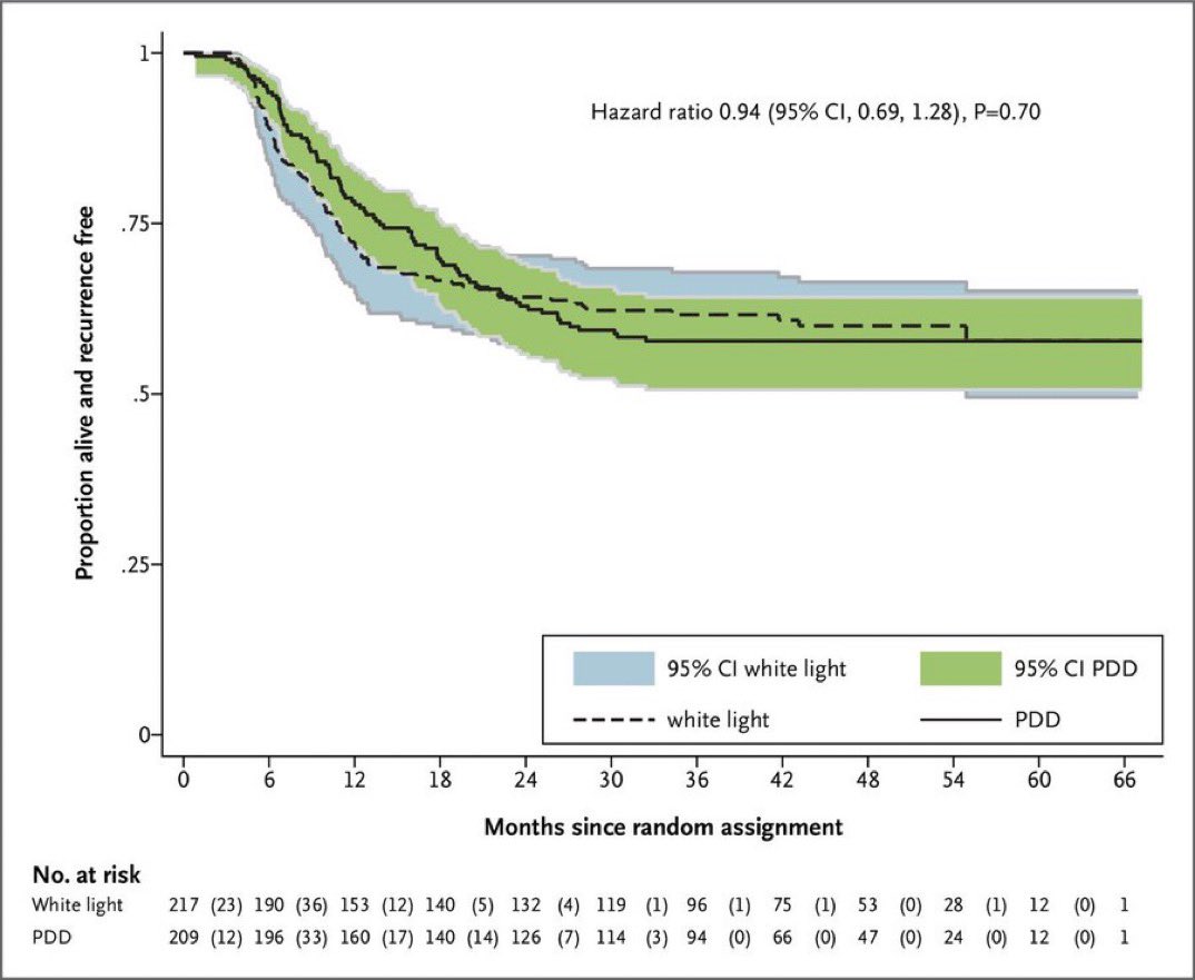 Let the debates start (again!) PHOTO: Randomized trial PDD-guided TURBT did not reduce recurrence rates, nor was it cost-effective compared with WL at 3 years @NEJMEvidence @ParamMariappan @EmmaHall71 @BAUSurology @siadaneshmand #bladdercancer evidence.nejm.org/doi/full/10.10…