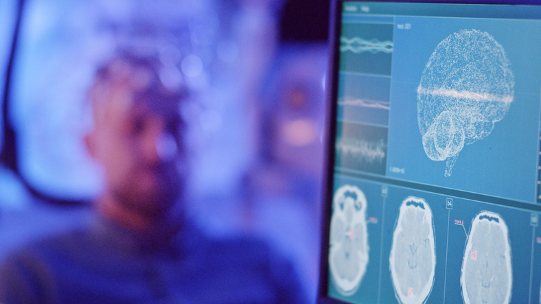 INTERVENTIONAL PSYCHIATRY | Given the evidence, it may be considered unethical to not discuss #TMS as a treatment option for patients who are treatment naïve or who have failed one antidepressant in the current episode. ow.ly/Tiz350KYpqk #MentalHealth #PsychTwitter