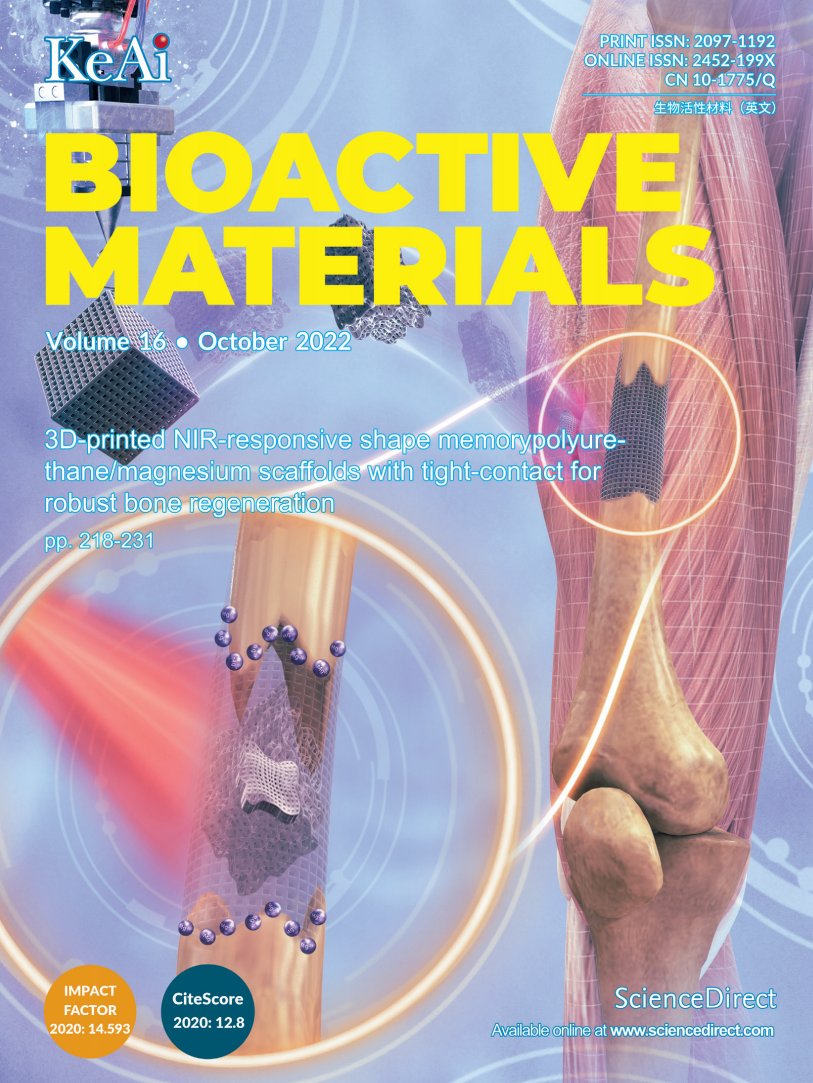 October 2022 issue is available now.
Check out a variety of exciting research and review articles. 
#OpenAccess
sciencedirect.com/journal/bioact…
