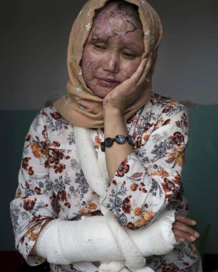 BasiriDr's tweet photo. @Alirezaa_ahmadi We need a united Afghanistan in support of Hazaras. #StopHazaraGenocide https://t.co/CDuAbIVBAR
