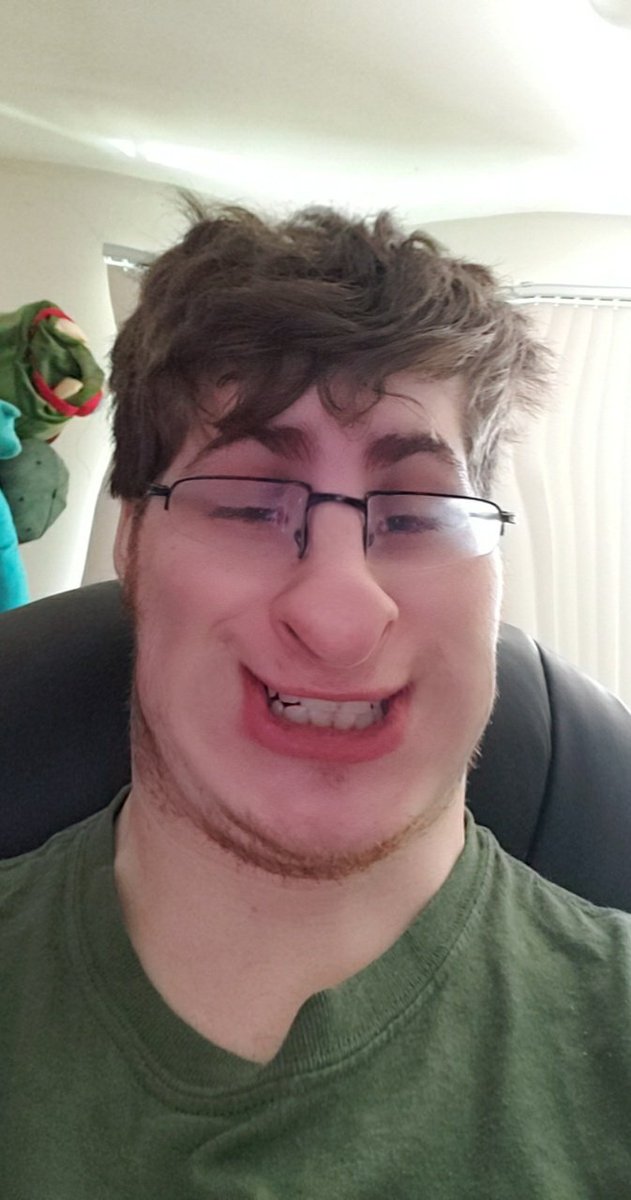 YourPalRoss's tweet photo. #dreamfacereveal https://t.co/6ifBqdHK8N