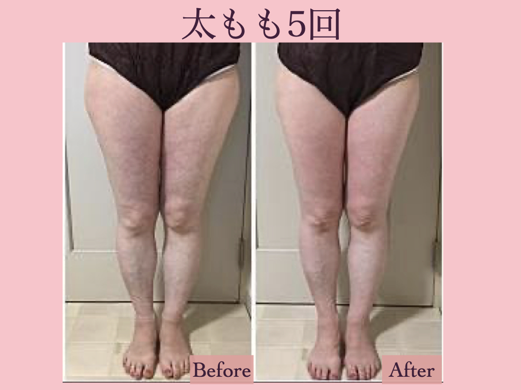 秋葉原エステ Twitter Search Twitter