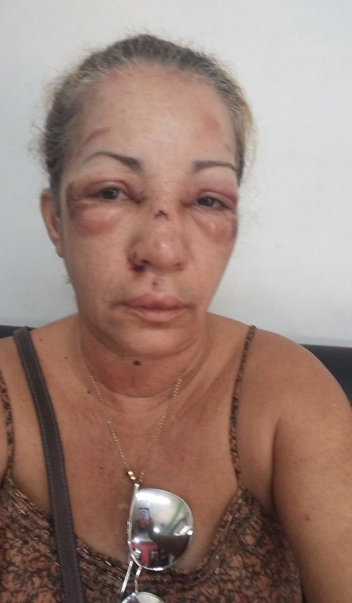 En el 2019 la señora Marisol Caraballo fue agredida de forma brutal por supuestamente el mismo individuo. Aquí la foto del 2019. Debemos revisar nuestra justicia y políticas criminales. URGENTE!