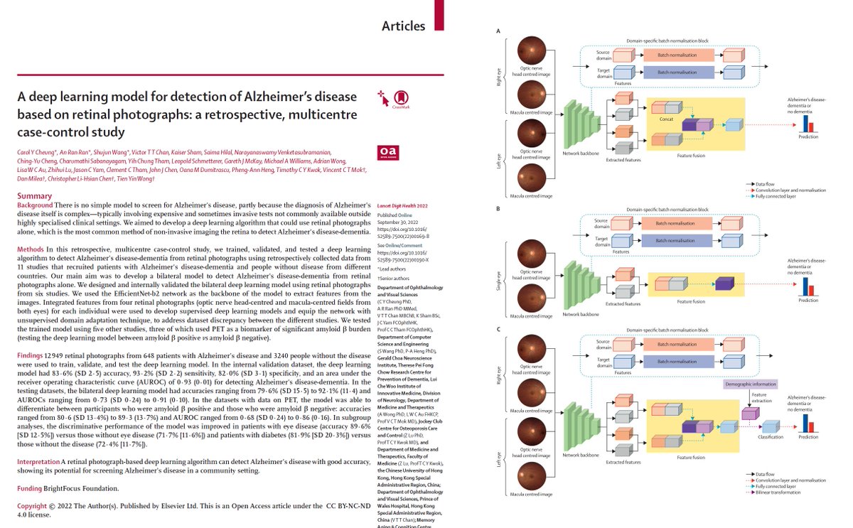 Carol Y Cheung (@carolcheung1023) on Twitter photo A #deeplearning model for detection of #AlzheimersDisease based on retinal photographs <a href="/CUHKMedicine/">CUHK Medicine</a>
sciencedirect.com/science/articl… A #deeplearning model for detection of #AlzheimersDisease based on retinal photographs <a href="/CUHKMedicine/">CUHK Medicine</a>
sciencedirect.com/science/articl…
