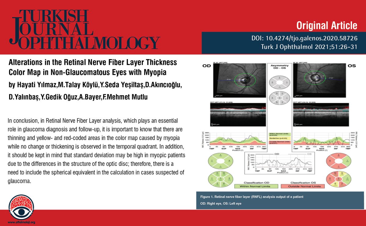 TurkJOphthalmol's tweet photo. Alterations in the Retinal Nerve Fiber Layer Thickness Color Map in Non-Glaucomatous Eyes with Myopia
You can see the free full text of the research by Hayati Yılmaz et al.
Link : https://t.co/qysIngDX5U
#Myopia #retinalnervefiberlayer #glaucoma https://t.co/wuuYMesNW2
