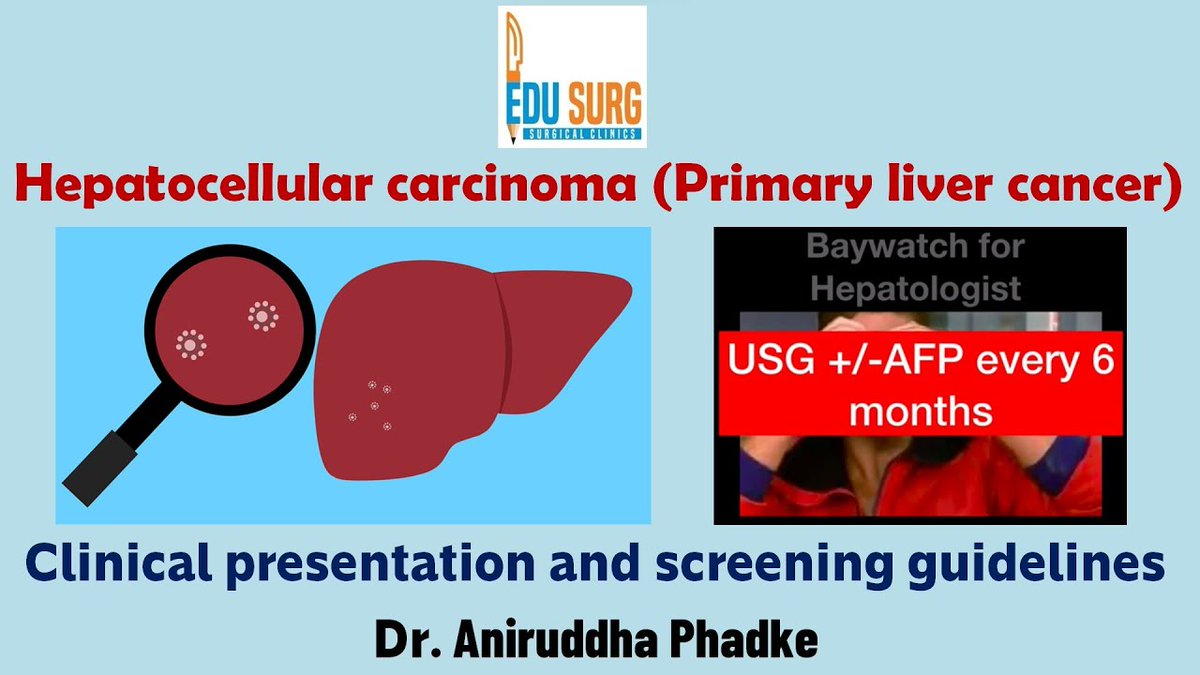 edusurg_clinics's tweet photo. Hepatocellular Carcinoma (Primary Liver Cancer) / Symptoms &amp; Signs / Screening/ How To Detect Early.  Click here to watch the full video:  https://t.co/MEVkocBSBO

#HepatocellularCarcinoma #PrimaryLiverCancer #LiverCancer #ChronicLiverDisease #Surgery  #surgeon #EduSurgClinics https://t.co/3BNLSvK6b1