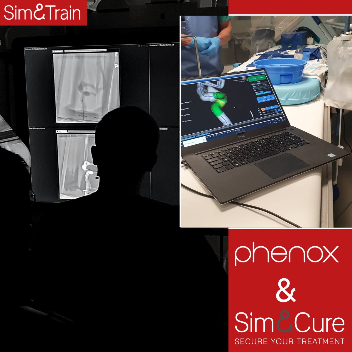 SimAndCure's tweet photo. One Workshop is over, several more to go!
The last #workshop in Stuttgart in collaboration with @phenox_neuro 
We were pleased to see that the attended INRs had a good training using Sim&amp;Train!
We thank our partner phenox for this opportunity!
#Simandtrain #training #medtech https://t.co/dlD9HiRcsO