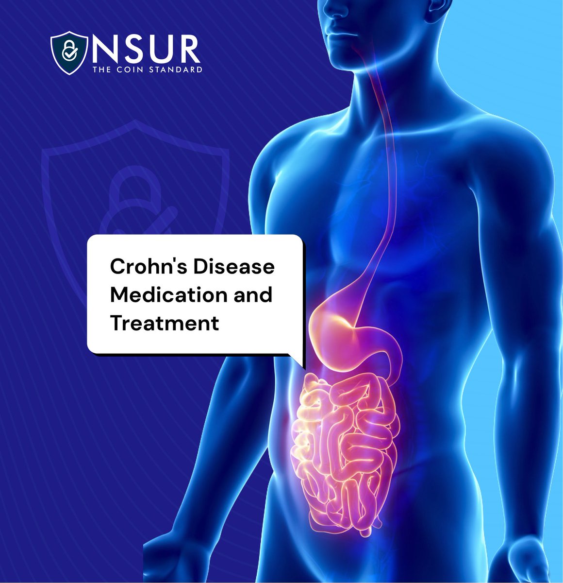 NsuRcoin's tweet image. Crohn’s Disease Medications 💊

Stay healthy with NSUR 🛡

Read more📚,

blog.nsurcoin.com/crohns-disease…