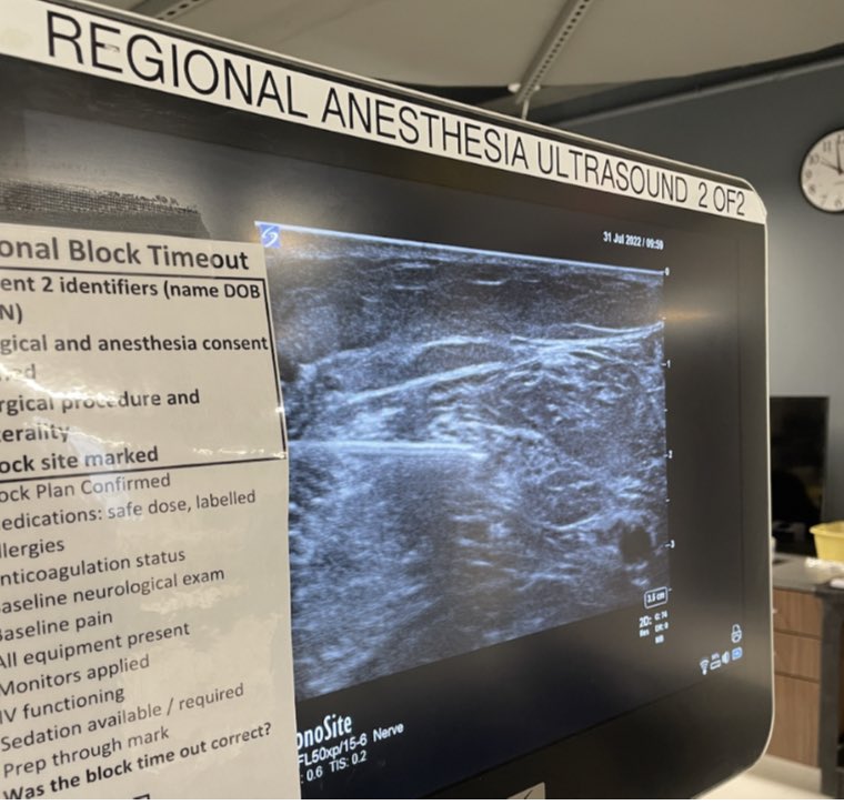 Each year in the fall, our regional department hosts a workshop, open to all residents and fellows. We practice needling, reviewing anatomy, and doing blocks on cadavers. Attending Dr. Jeremy Armbruster with CA-3 Dr. Arianna Cook reviewing some lower extremity nerve blocks.