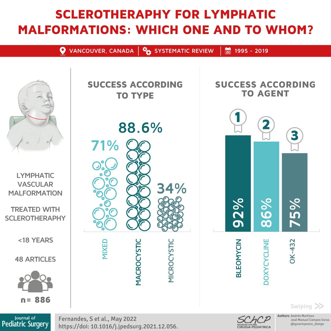 StayCurrentMD's tweet photo. New Infographic 📄 by @Schcp
"#Sclerosingagents in the #management of #lymphaticmalformations in children: A systematic review" Sairvan Fernandes https://t.co/Ovgblefsnc. 

Full Article: https://t.co/Mlcpvx69uM

#SoMe4PedSurg #pedsurg @jpedsurg https://t.co/vvVJlBzuxD
