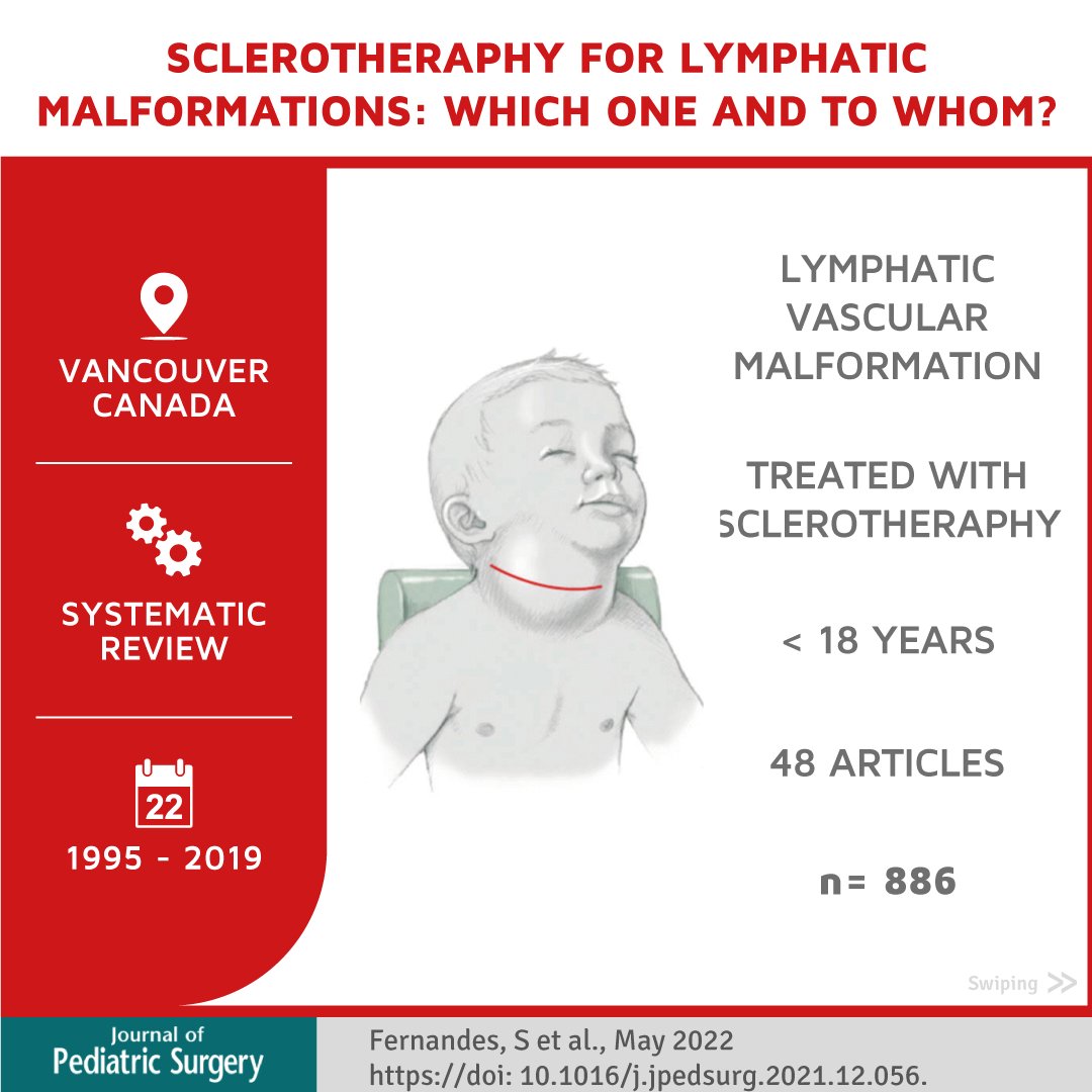 New Infographic 📄 by <a href="/Schcp/">Sociedad Chilena de Cirugía Pediátrica</a>
"#Sclerosingagents in the #management of #lymphaticmalformations in children: A systematic review" Sairvan Fernandes et.al. 

Full Article: doi.org/10.1016/j.jped…

#SoMe4PedSurg #pedsurg <a href="/jpedsurg/">jpedsurg</a>