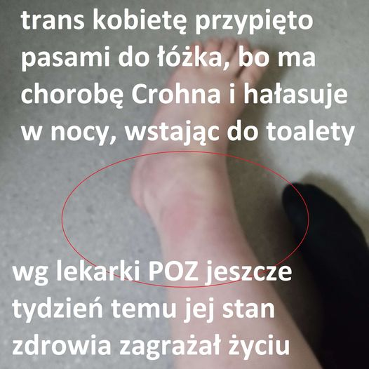 HebanMaja's tweet image. 1/ Proszę, przeczytajcie całość. To kwestia życia i śmierci trans pacjentki, która jest traktowana jak szkodnik.

W Szpitalu Klinicznym im. Karola Jonschera Uniwersytetu Medycznego im. Karola Marcinkowskiego w Poznaniu przebywa transpłciowa pacjentka, której prawa są łamane.