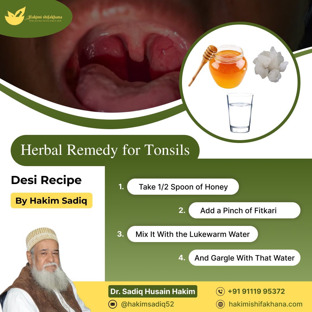 Herbal Remedy for Tonsils
.
#honey #tonsils #fitkari #lukewarm #breathspray #gargle #homeremedies #homeremediescure #hakimisadiqhussain #hakimishifakhana #indore #indorepost #bonehealth #doctor #shifa #cure