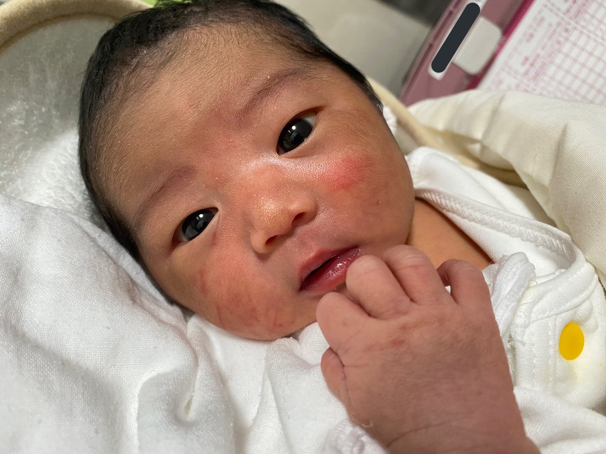 442299y's tweet photo. 2022.9.23   am7:29
2570g の女の子　
誕生しました。

1年前、私たち夫婦がご本部で結婚式を挙げた日。
予定より約2週間早く、この日を選んで産まれてくれました。
日々顔が変わっていて、その時その時の表情、動き、すべて愛おしい。
これからもいろんなあなたを見せてね。 https://t.co/IqOseATsDW