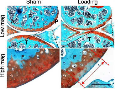 ASBMR (@asbmr) on Twitter photo A recent study in #JBMR used a nonsurgical, loading induced PTOA mouse model to investigate the protective action of EGFR signaling #ASBMR <a href="/BeierLab/">Frank Beier</a> <a href="/WileyBiomedical/">Wiley Biomedical Science</a>
ow.ly/bih950KZKWo A recent study in #JBMR used a nonsurgical, loading induced PTOA mouse model to investigate the protective action of EGFR signaling #ASBMR <a href="/BeierLab/">Frank Beier</a> <a href="/WileyBiomedical/">Wiley Biomedical Science</a>
ow.ly/bih950KZKWo