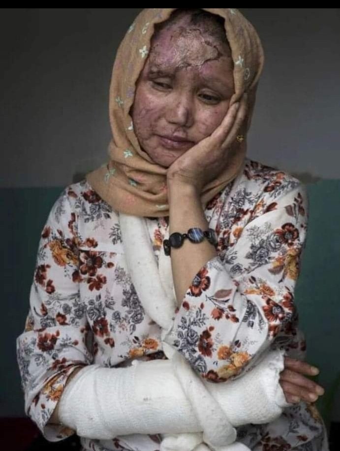 MustafaRamtin65's tweet photo. #StopHazaraGenocide https://t.co/oyNBMVNSLt