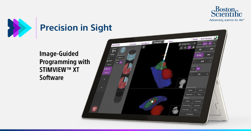 BSCDBS's tweet photo. When it comes to Deep Brain Stimulation programming, a picture is worth a thousand words. Learn how STIMVIEW™ XT Software makes programming easier. #DBS #stimviewxt #imageguidedprogramming