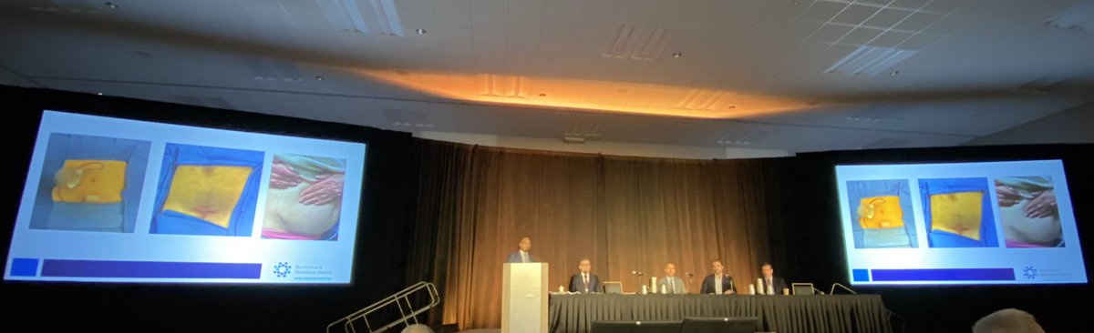FSheckley's tweet image. Great talk by Dr Ahmed &amp;amp; panel regarding utility of Single Port Robotic surgery at #WCET22 
Comparable outcomes to multiport with better patient’s perception.
Lucky to be part of a great program @HUMCUrology offering opportunities for learning with @RoboticsUrology @mdstifelman