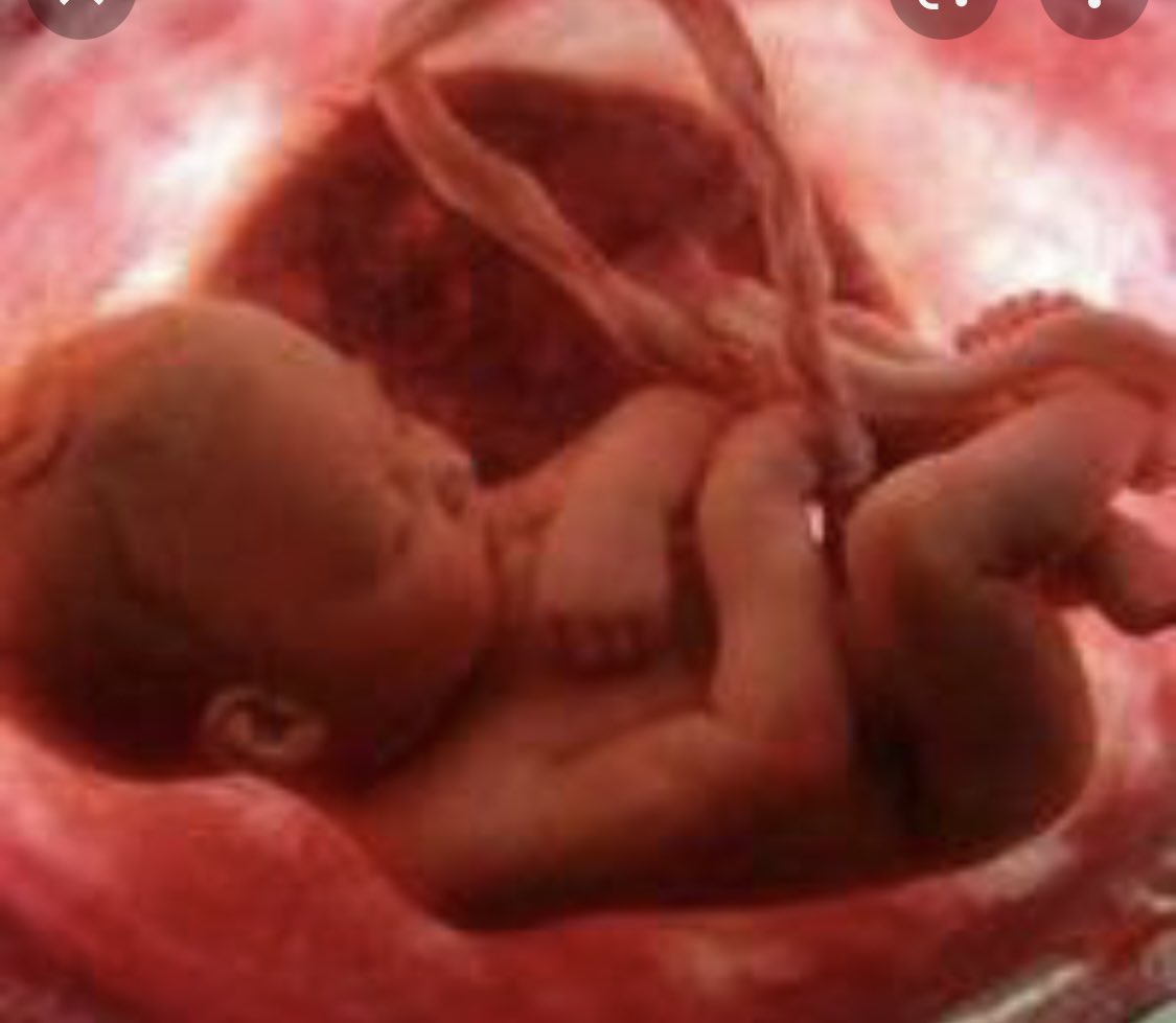 josemiguel45's tweet photo. Gobierno nuevamente causando polémica !!! buscando legalizar el ABORTO sin cáusales. https://t.co/DQSgmfVjnr
