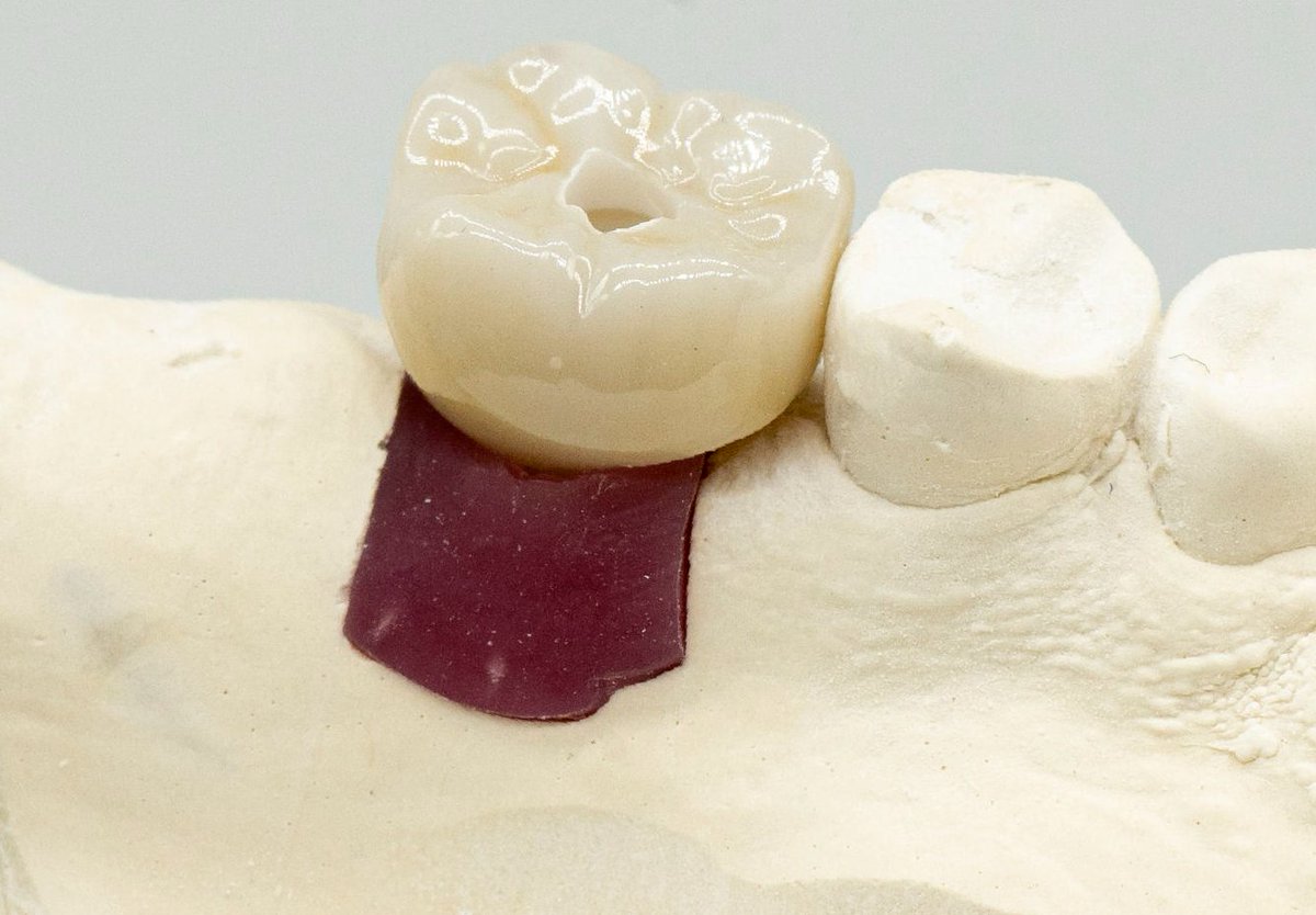ROE Dental Lab tweet media