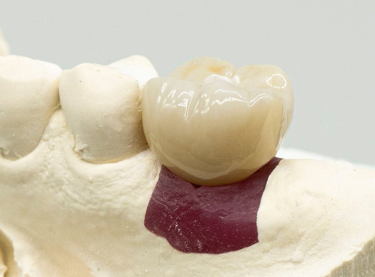 ROE Dental Lab tweet media