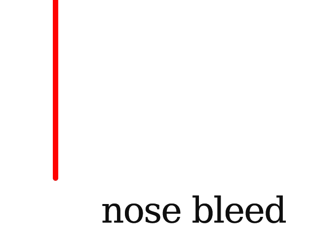 The excellent Nose Bleed by @stanwixbuster is one of 7 Texture games at this year's Interactive Fiction Competition playable here ifcomp.org/ballot?alphabe… The author has also created this great guide for hacking Texture! stanwixbuster.co.uk/docs/hacking-t…