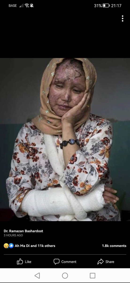 ChamranMorteza's tweet photo. @UN #StopHazaraGenocide_Afghanistan https://t.co/baE5exg90T