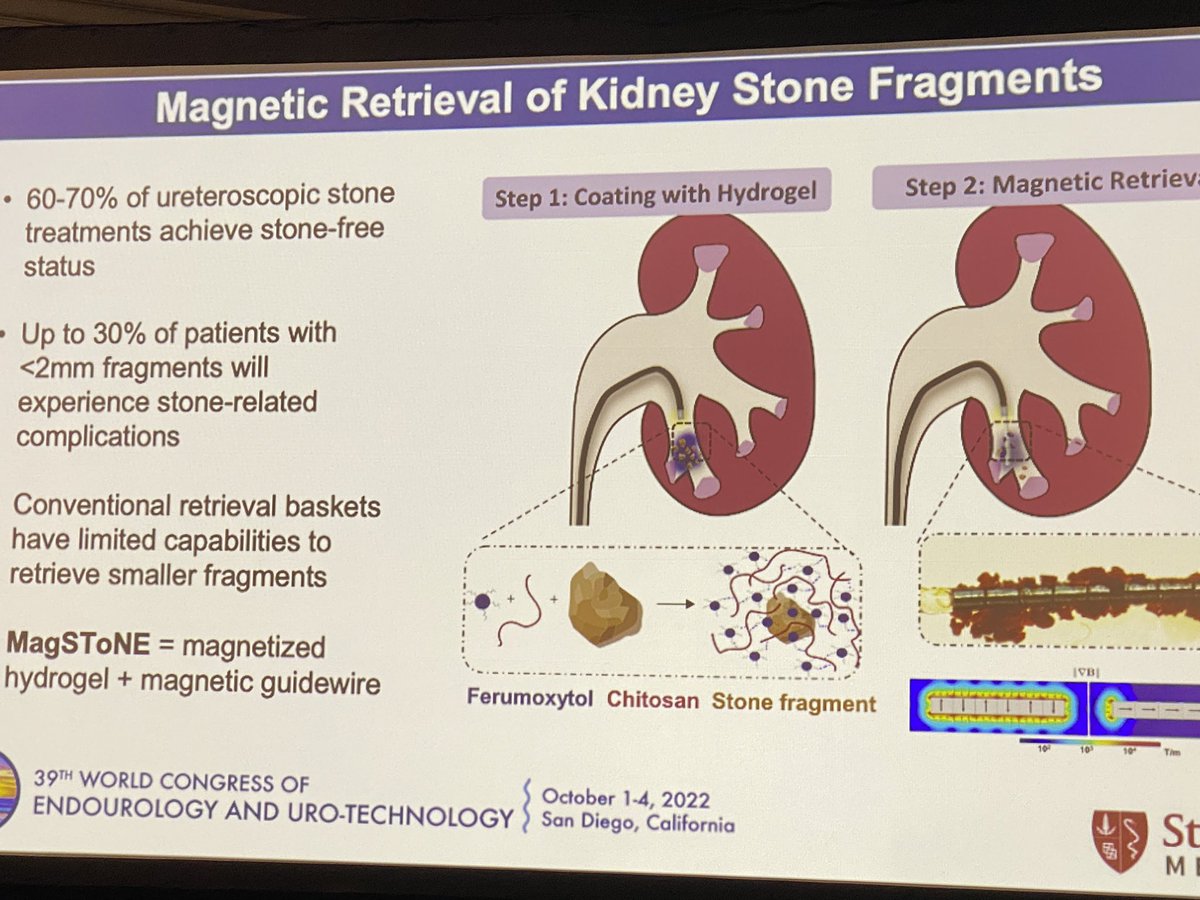Incredible paper presented at #WCET2022 by @LiaoJoseph of @StanfordMed about magnetic retrieval of stone fragments … impressive and promising … congrats to everybody for the effort! Looking forward to see clinical applications !