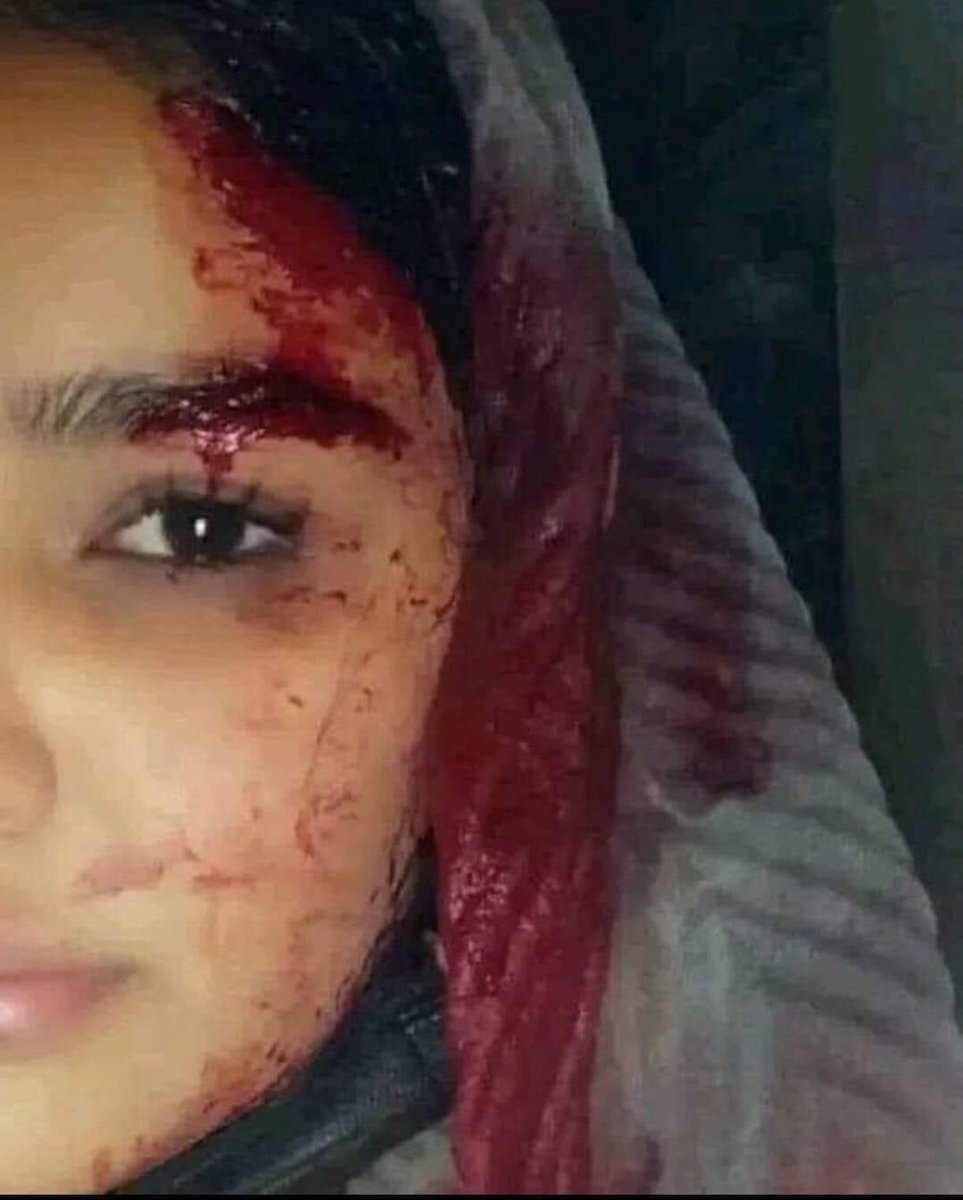 AdibAliDad1's tweet photo. Hazara kids and people are being perished by the terrorist group #Taliban            #StopHazaraGenocide https://t.co/1Qa1Og0SBN
