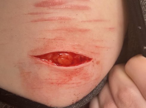 plutoast4's tweet photo. here’s some recent spam just to meet some new people on shtwt
THIS IS ALL MAKEUP/SFX
🖤
🖤
🖤
🖤
🖤
🖤
🖤
🖤
🖤
🖤
🖤
🖤
🖤
🖤
🖤
🖤
🖤
🖤
#shtwt #beanstwt #armgills #madeofstyro #madeofstyrofoam #styro #sliceytwt https://t.co/EOwxLefvcU