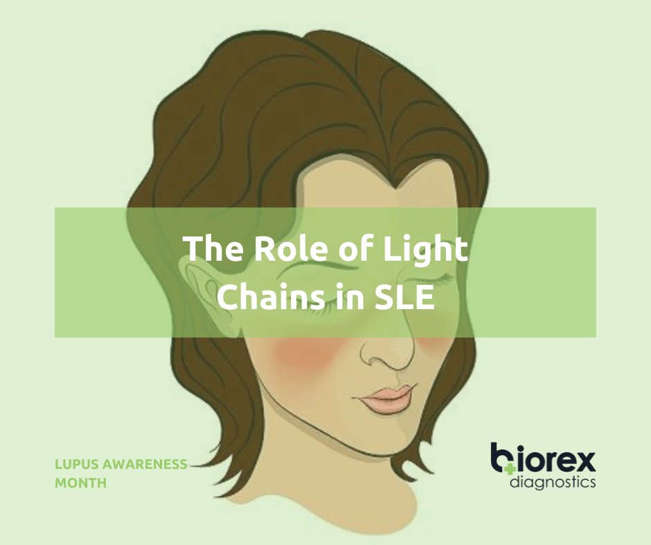 biorexdiagn's tweet image. This year Biorex Diagnostics are celebrating #LupusAwarenessMonth, placing a focus on the most common form of lupus, systemic lupus erythematosus (SLE).
Check out our blog to discover the role of light chains in SLE: bit.ly/3RvHuNM
#SLE #LightChains #DiagnosticsForLife